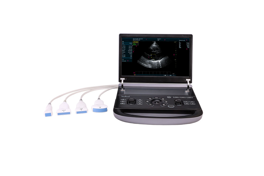 Portable Ultrasound Diagnostic Probe