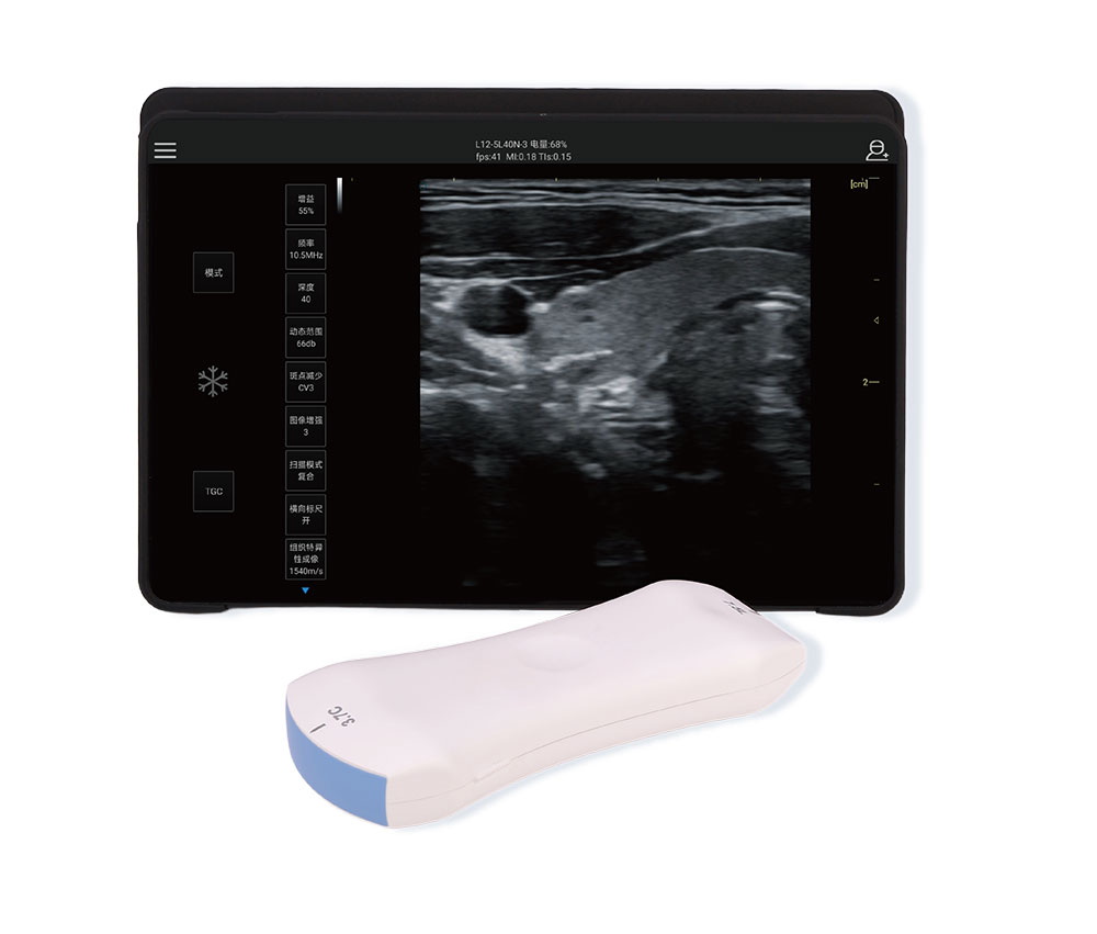Handheld Probe (AI Available) & Ultrasound Patch