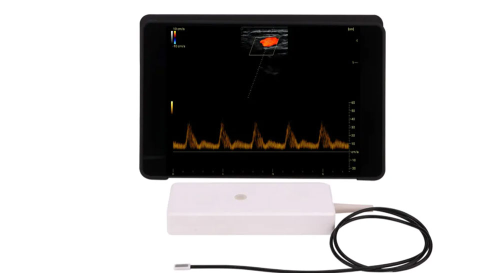 怡声微纳柔性贴片超声，重构颈动脉全周期精准监测新格局